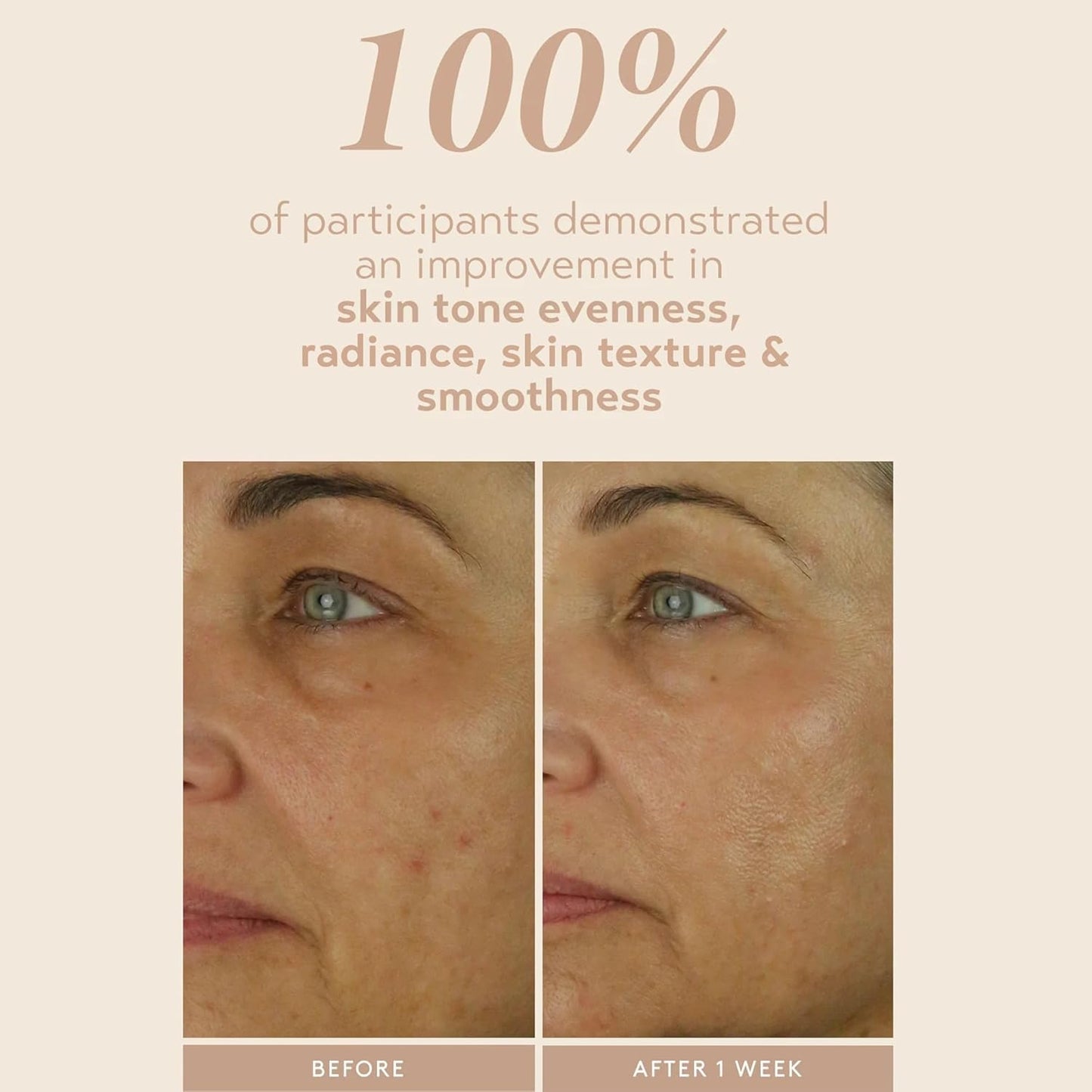 SHANI DARDEN SKIN CARE Retinol Reform with 1% Encapsulated Retinol Serum for Face & Neck, Gentle Slow-Release Retinol Face Serum with Tripeptide for Wrinkles, Fine Lines & Uneven Tone, 0.3 fl oz-GlimoraGlow