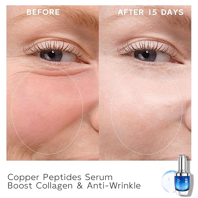 Copper Peptides Serum for Face - Peptides Collagen Renewal & Anti-Aging Serum - GHK-Cu, EGF, Hyaluronic Acid,Collagen - Anti Wrinkle, Firming, Moisturizing-Korean Skin Care,25mL/0.88 Fl Oz-GlimoraGlow