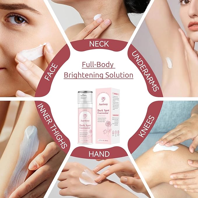 Dark Spot Remover for Face and Body - Dark Spot Corrector for Face - Sun Spots, Age Spots, Freckles & Melasma Remover - Brown Spot Corrector Evens Skin Tone for All Skin Type 1.7 Fl Oz-GlimoraGlow