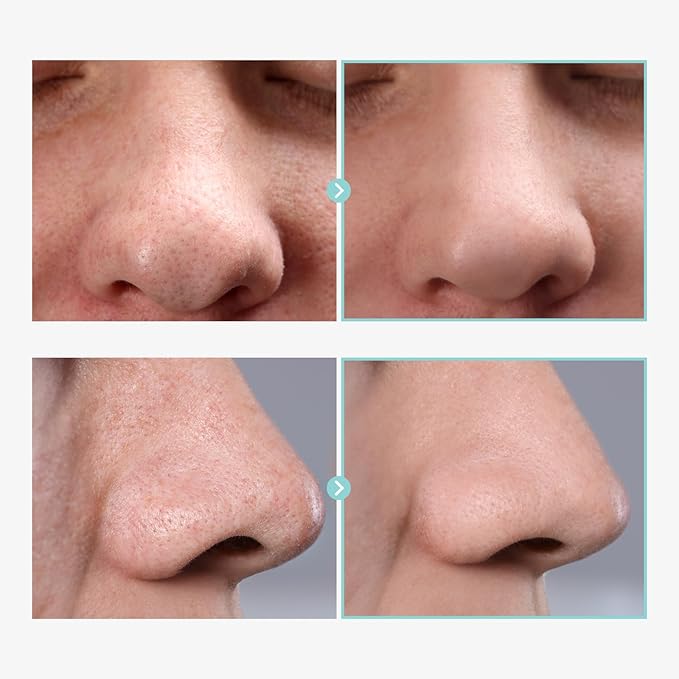 Pore Tightening Serum, Instantly Reduces Pores, Smooths Skin & Strengthens Barrier, Formulated With Niacinamide & Allantoin, Pore Minimizer For Face, Korean Skin Care, 30ml, 1.01 fl. oz.-GlimoraGlow