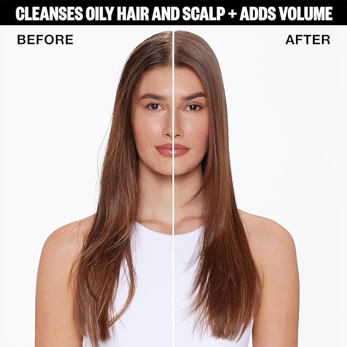 IGK FIRST CLASS Charcoal Detox Dry Shampoo | Volume + Soothes Scalp + Balance Oil | Vegan + Cruelty Free | 6.3 oz (Pack of 2)-GlimoraGlow