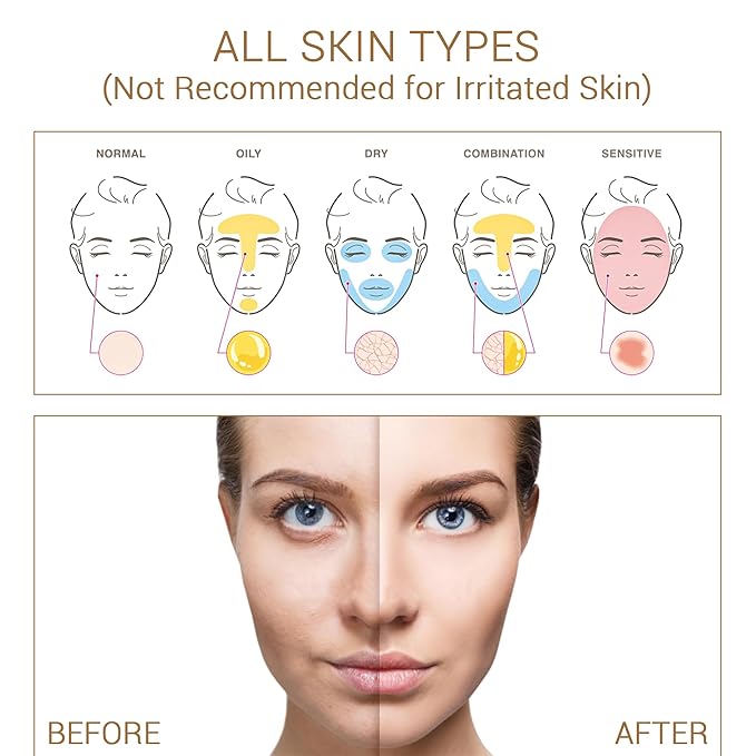 Niacinamide with Salicylic Acid Serum for Face, Hydrating Dark Spot Facial Serum & Plumb Skin, Daily Skincare Essential, 1 fl. oz, Made in Europe-GlimoraGlow