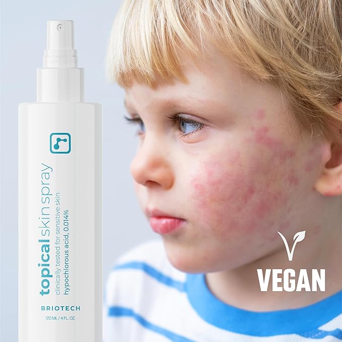 BRIOTECH Topical Skin Spray, Hypochlorous Acid Spray for Sensitive Skin, HOCl Facial Mist, Full Body Support Against Irritation, Calm Redness, Soothe Foot & Scalp, 2 oz Travel Size-GlimoraGlow