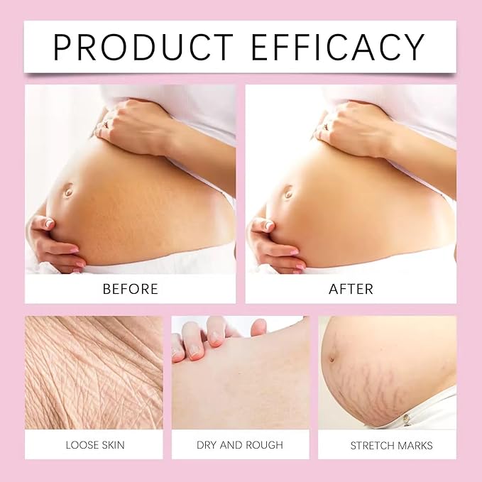 Stretch Mark Pregnancy Oil, Natural Oil Skincare Body Oil Serum for Scars and Stretch Marks, Face with Vitamin E & A for Sensitive Dry Skin and Body Moisturizer-GlimoraGlow