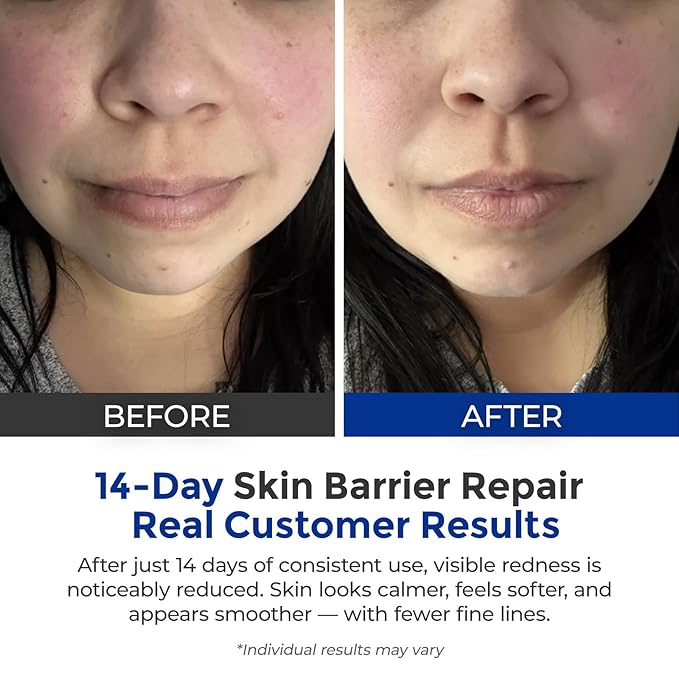 Intensive Repair Serum, 15%Hyaluronic Acid for Sensitive Skin Anti Aging Ultra Hydrating Serum for Face Calming Barrier Repair Redness Relief with Ceramides Centella 30Vials Daily Travel Care-GlimoraGlow