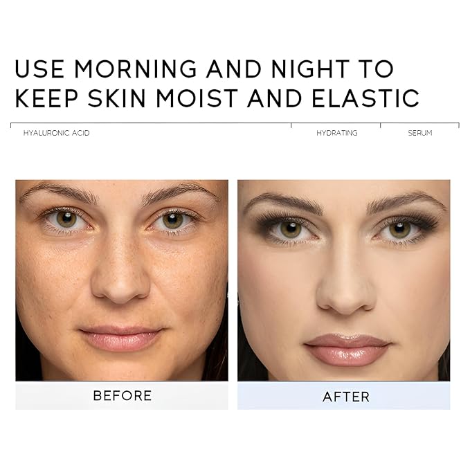 Hyaluronic Acid Serum for Face, Hydrating Face Serum for Dry Skin W/Hymagic-4D, Squalane, Vitamin C & E for Plumping, Hydrating & Anti-Aging Serum, Skin Care, 1.06fl.oz, Pack of 2-GlimoraGlow