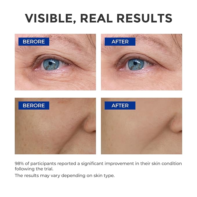 Retinol Serum for Face, Anti Aging Serum, Retinoid Collagen with Vitamin E Resurfacing Facial Rapid Fine Lines Repair, Brightening Pore Minimizer for Face Daily Skin Care Treatment 1oz-GlimoraGlow