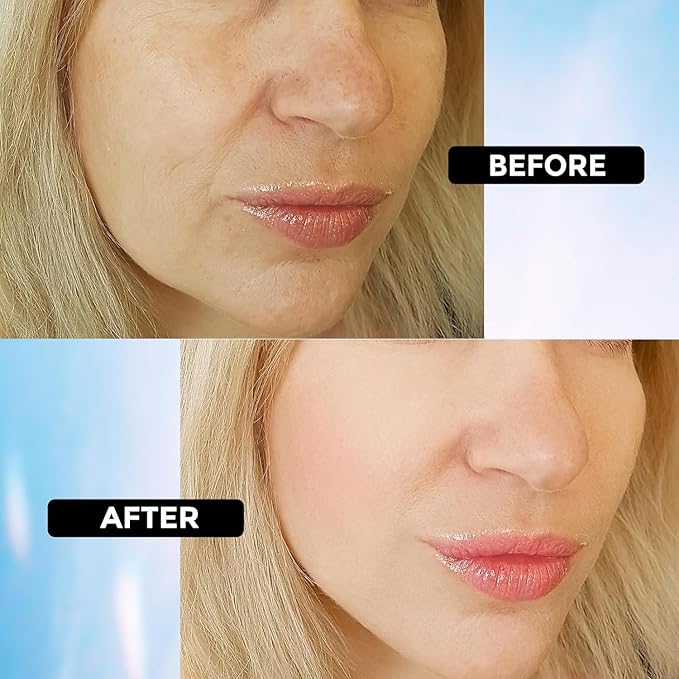 Hyaluronic Acid Serum for Face Anti Aging, Fine Lines, Dark Spots, & Dry Skin - Hydrating Facial Serum - Best Face Serum for Moisturizing and Wrinkle Reducing, 1 fl oz-GlimoraGlow