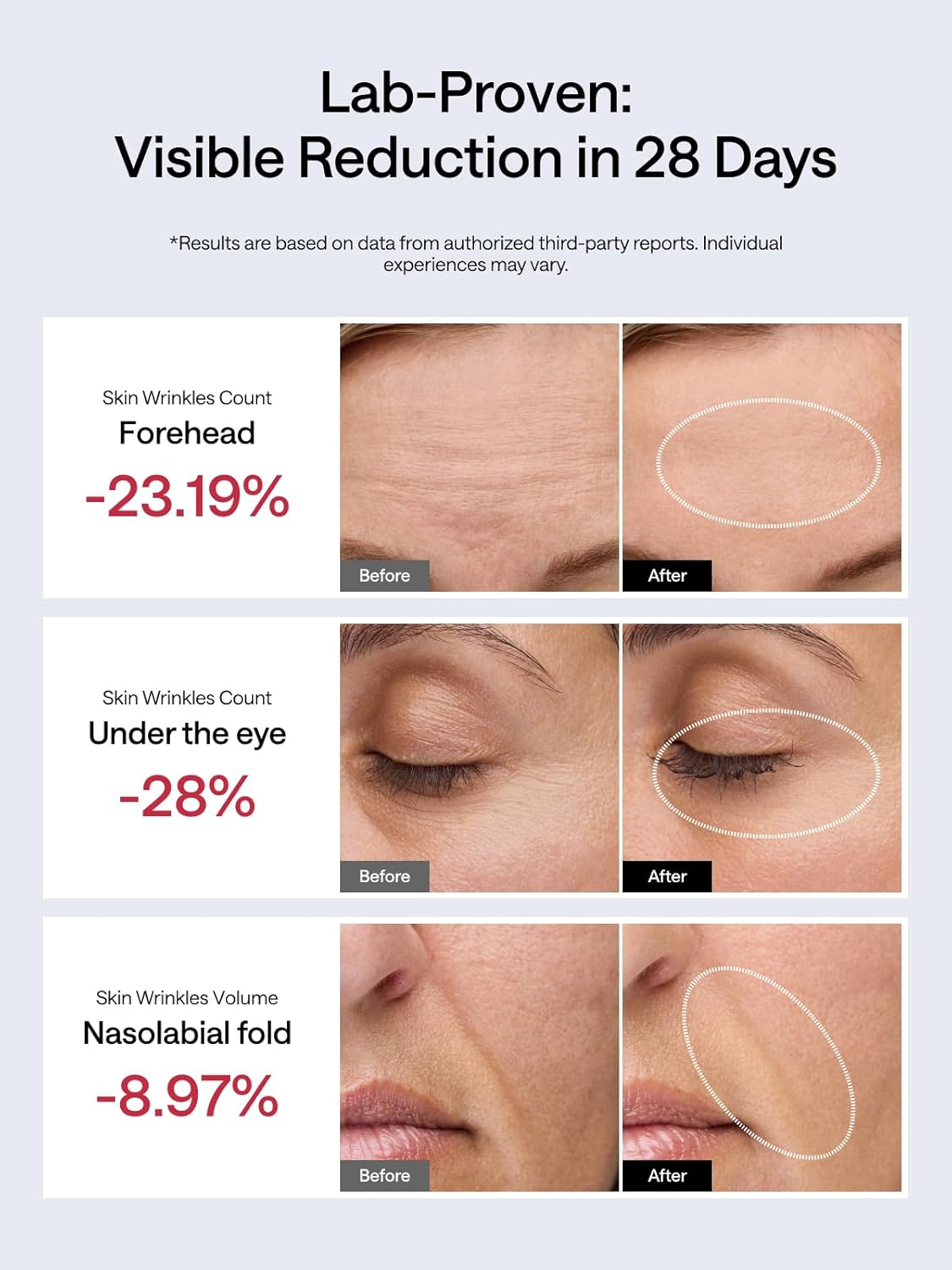 JMOON NouvelleSkin Facial Toning Device, FDA-Cleared Microcurrent Facial Device and Red Light Therapy for Face, 4 Modes & 5 Intensity Levels for Personalized Face Lift & Smoothing. M30U PR-GlimoraGlow