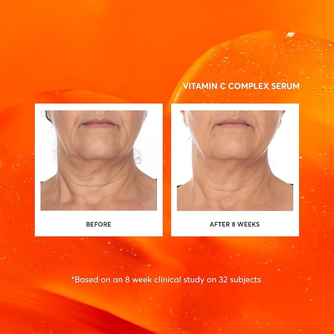 Naturium Vitamin C Complex Face Serum, Anti-Aging Facial Treatment with Hyaluronic Acid & Vitamin E, 1 oz-GlimoraGlow