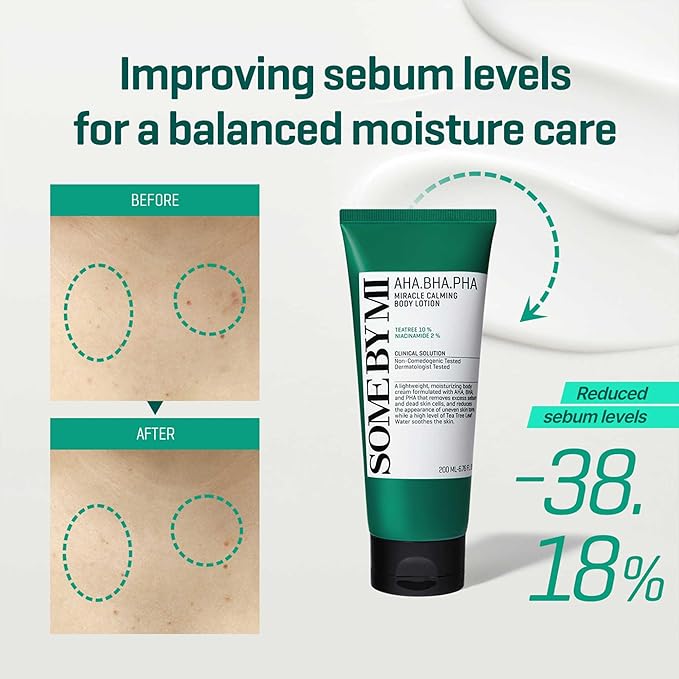 SOME BY MI AHA BHA PHA Miracle Calming Body Lotion – 6.76oz, 200ml – Korean Exfoliating Salicylic Acid Body Moisturizer for Dry Skin – Daily Hydration & Soothing Care with Centella – Korean Skin Care-GlimoraGlow