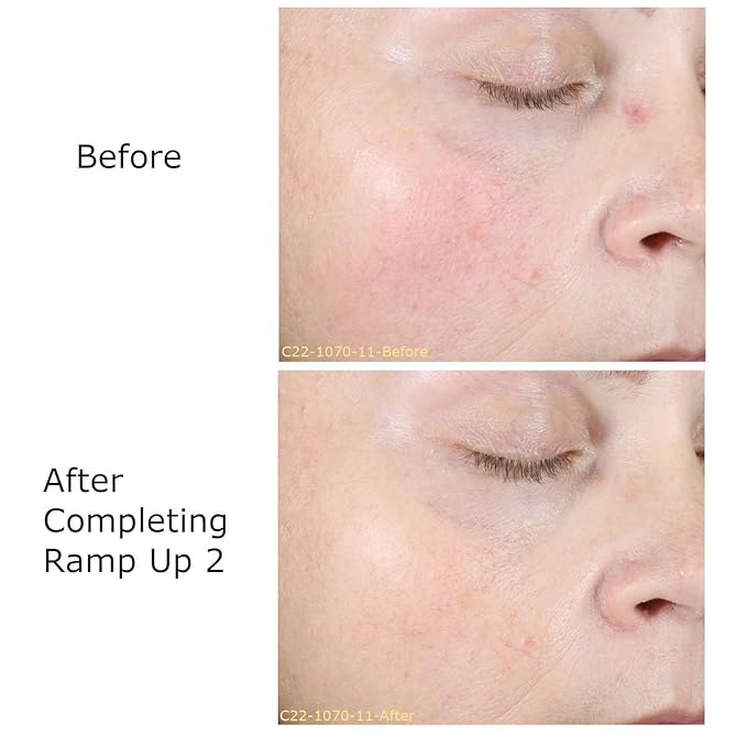 Hydrate & Soothe Beauty Collection Gift Bundle / Starter Kit, Activator with 0.05% Retinol Cream, Ramp-Up Regimen 2 & RHR Overnight Mask, Skin Care Routine, For All Skin Type-GlimoraGlow