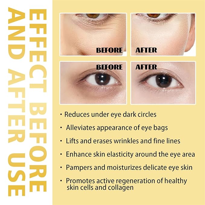 Time Eraser Rollerball Castor Oil and Frankincense, Time Eraser Rollerball, Castor Oil and Frankincense Eye Roller for Reducing Dark Circles and Bags Under Eyes-GlimoraGlow