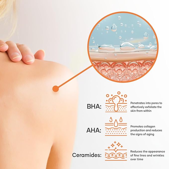 Salicylic Acid Body Wash - Skin Non-drying, Gentle Exfoliates Rough and Bumpy Skin, Body Acne Wash, BHA & AHA - Unscented Exfoliating Body Wash, Made in USA - (16 fl oz x 2)-GlimoraGlow