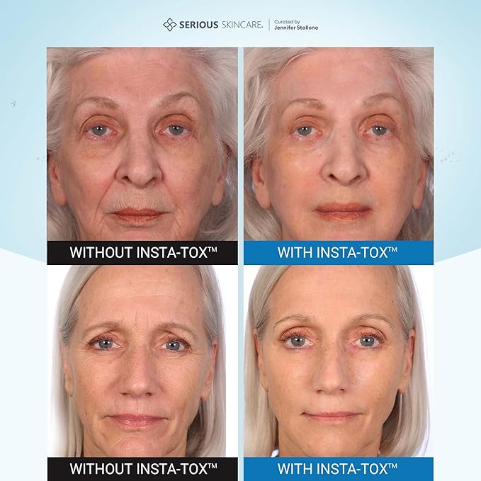 Serious Skincare INSTA-TOX Instant Wrinkle Smoothing Face Serum - Improves Appearance of Fine Lines - Temporary Skin Tightener - Line Filler .75 oz (1Pack)-GlimoraGlow