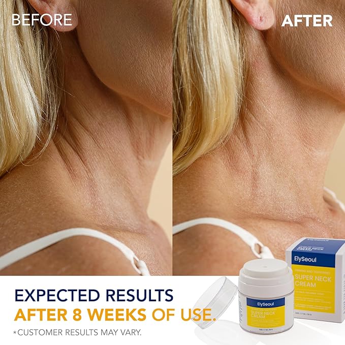 Korean Neck Cream for Firming & Tightening: Neck & Chest Anti-Aging Treatment for Crepey Sagging Skin & Wrinkles-GlimoraGlow