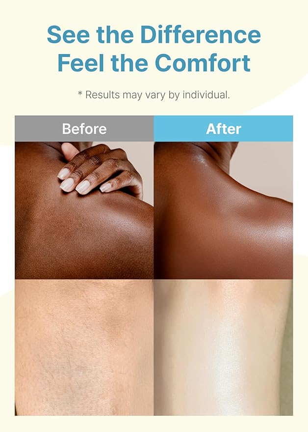 Derma B | Daily Moisture Body Oil | 99% Natural Argan & Sweet Almond Oil | Shower Oil for Dry Sensitive Skin | Light & Long-Lasting Hydration | Skin Body Care Oil with Peach Scent | 6.78 fl oz (200ml)-GlimoraGlow