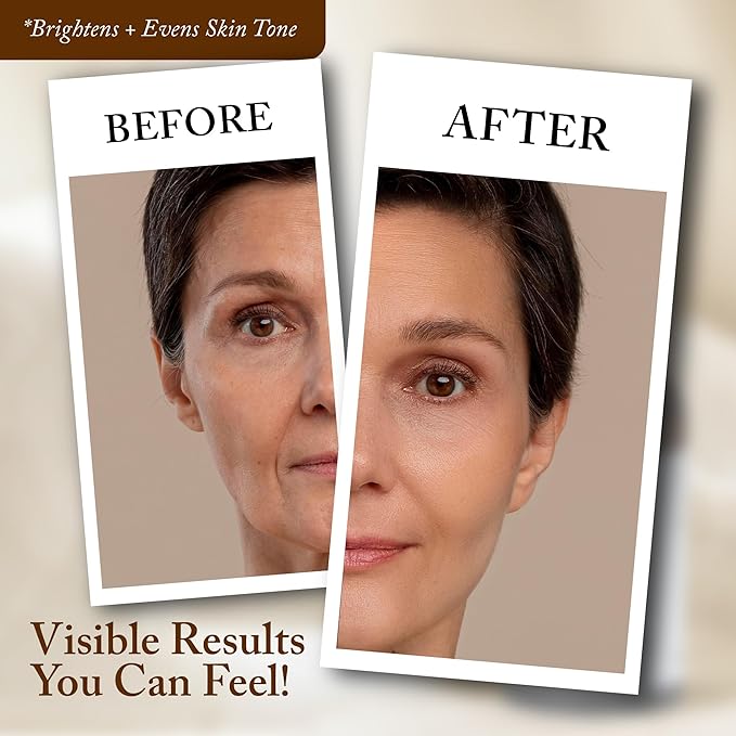 4 Oz Face Lift Mist - Hydrating Face Moisturizer with Green Tea & Niacinamide - Natural Skin Care Spray with Antioxidants, Amino Acids & Aloe for Brighter, Softer Complexion-GlimoraGlow