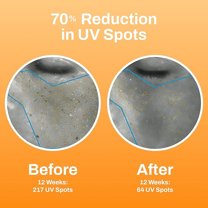 Photozyme DNA Youth Recovery Facial Serum | 1.7 Fl Oz-GlimoraGlow