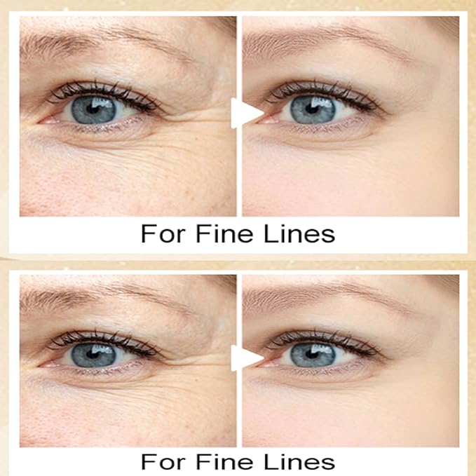 20g Eye Cream with Electric Massage, Moisturizing Anti-Wrinkles Eye Cream, Anti Aging Eye Cream for Dark Circles and Puffiness, Results in 3-4 Weeks to Reduce Fine Lines-GlimoraGlow