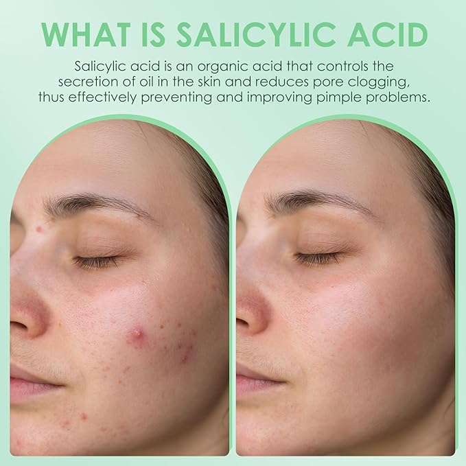 AUSLKA Salicylic Acid Oil Balancing Spray with 2% Salicylic Acid Regulates Skin Balance for Pimple and Oily Skin, Fruit Acid Spray for Face & Body (3.4 Fl Oz)-GlimoraGlow