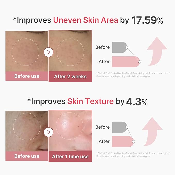 medicube PDRN Pink Collagen Exosome Shot Serum 2,000 PPM | Liquid Skin Booster | Exosome, Salmon DNA PDRN, Spicules | Uneven Skin Tone, Pore Care, Skin Texture | Korean Skin Care 1.01 fl.oz-GlimoraGlow