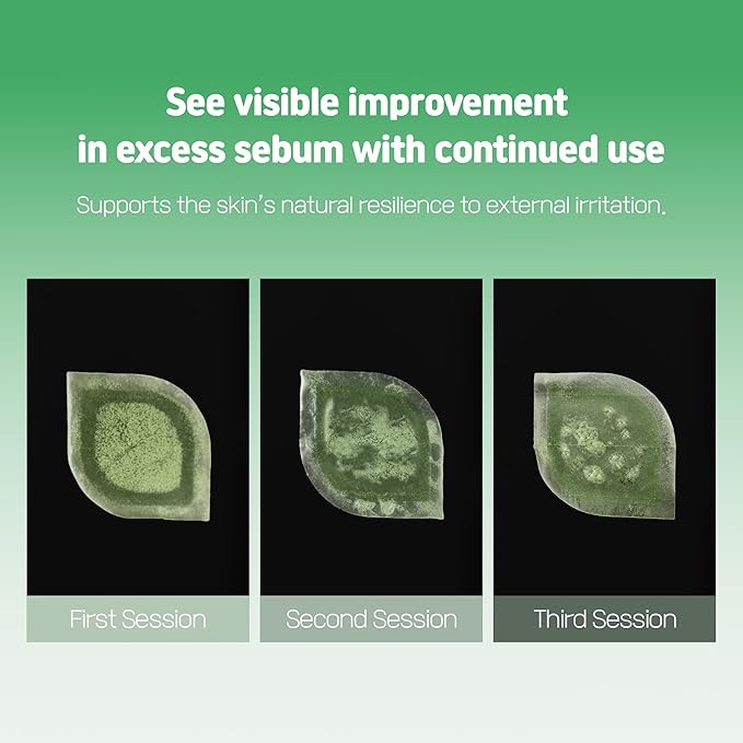 Cica Bio Spot Control Patch (1 Box, 62pcs) | Soothing Acne Patch for Redness & Blemishes | With Cica, Niacinamide & Tea Tree | Gentle for Sensitive Skin | Korean Skincare-GlimoraGlow