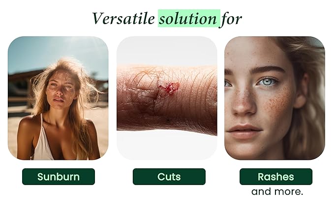 100% Pure & Organic Aloe Vera Spray, Clinically tested & Dermatologist approved, Hydrates & Heals Dry & Damaged Skin & Hair- 12 Oz-GlimoraGlow