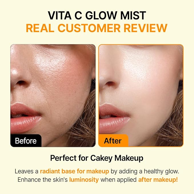 Vitamin C Mist with Niacinamide & Glutathione, Glow Mist for Dewy Skin, Makeup Setting Spray for face, Korean Skin Care, Vegan, 3.38 Fl Oz-GlimoraGlow