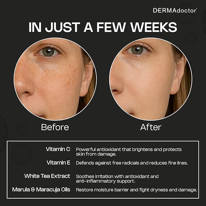 DERMAdoctor Night Face Oil Toner Anti-Aging Hydrating - 20% Vitamin C Ester, Vitamin E, Ferulic Acid, & Marula Oil for Face | Concentrated Vitamin-C Ester Facial Oils | Dermatologist Formulated - 1 Oz-GlimoraGlow