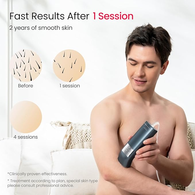 IPL Laser Hair Removal for Men, Dual Lights 100W, 35°F Sapphire Ice-Cooling, Quadruple-Pulse PHR Mode for Stubborn Hair, at Home Hair Removal Device for Armpits, Chest and Leg-GlimoraGlow