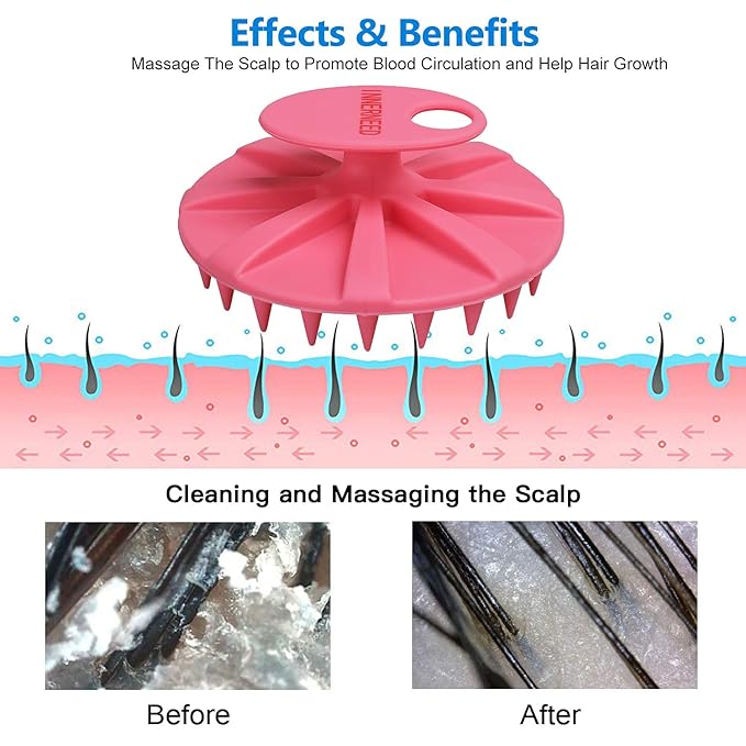 INNERNEED Scalp Massager Shampoo Brush, Wet & Dry Manual Scalp Care Head Scrubber Hair Washing, Soft Silicone Bristles, for Hair Growth, Dandruff Removal, Comfortable for All Hair Types (Pink)-GlimoraGlow