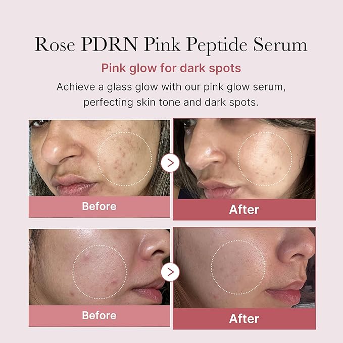 medicube PDRN Pink Peptide Serum, Pink glow serum, Peptide, Niacinamide, Hydrating & Moisturizing & Firming, Uneven Skin Tone, Korean Skincare | 1.01 fl.oz. (1.01 fl.oz., Rose PDRN (Vegan))-GlimoraGlow