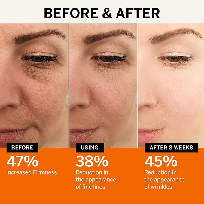 Vitamin C Face Serum: Anti Aging Super Vit C Facial Serum with Ferulic Acid Pure L-Ascorbic Acid, Vitamin E and Hyaluronic Acid for Dark Spots and Skin Care-GlimoraGlow