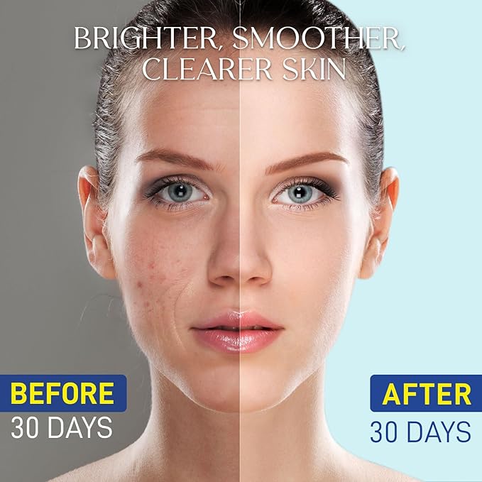 Niacinamide Serum 15% for Face – Dark Spot Corrector, Pore Minimizer, Oil & Blemish Control, Brightening & Hydrating with Vitamin C, B5, Peptides & Hyaluronic Acid – 1.7 Fl Oz-GlimoraGlow