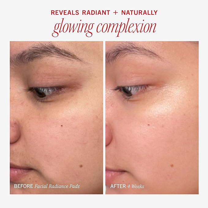 First Aid Beauty – Facial Radiance Pads with Glycolic & Lactic Acids, Daily Exfoliating with AHA that Helps Tone & Brighten Skin, Makeup Prep Pads, Compostable for Daily Use, 60 Count, 2ct-GlimoraGlow