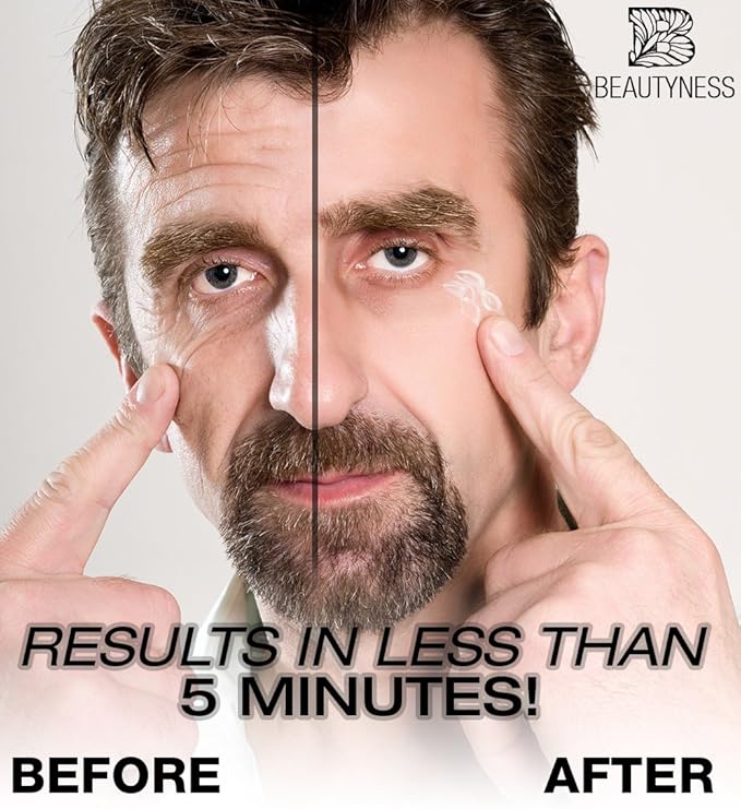 Instant Ageless Eye Cream – Anti Wrinkle Cream, Removes Under Eye Puffiness, Bags, Expression Lines, & Dark Circles. Powerfully Tighen & Lifts Sagging Skin. Disappears Before Your Eyes In Minutes.-GlimoraGlow