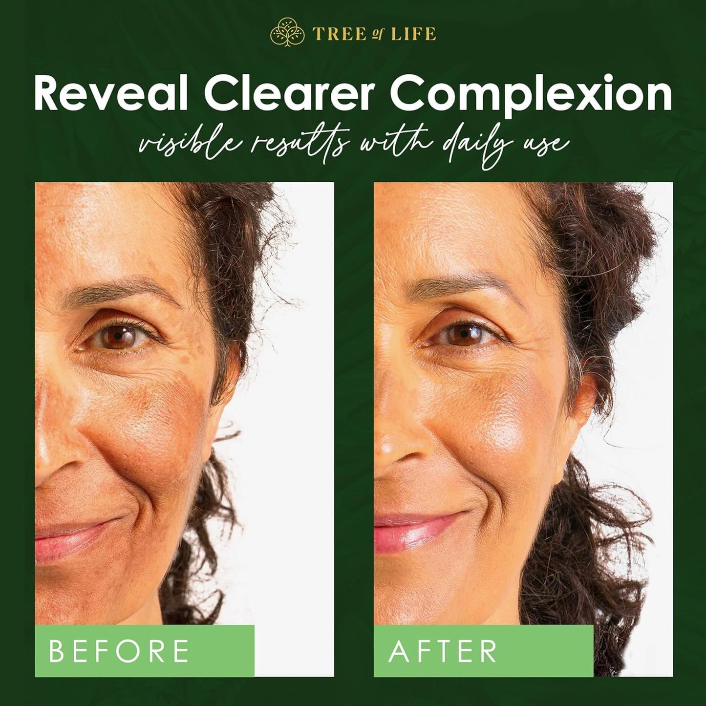 Tree of Life Beauty Niacinamide Vitamin B3 Serum, Hydrating Face Oil for Dark and Age Spots, Tightens Pores, Facial Serums for Sensitive Skin Care with Hyaluronic Acid and Vitamin E, 2 Fl Oz-GlimoraGlow