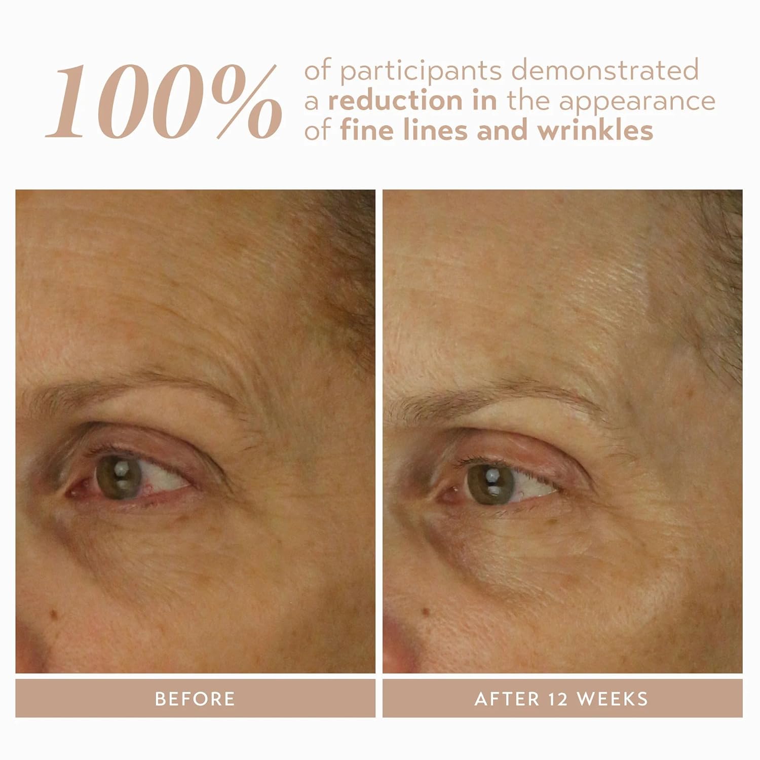 SHANI DARDEN SKIN CARE Retinol Reform with 1% Encapsulated Retinol Serum for Face & Neck, Gentle Slow-Release Retinol Face Serum with Tripeptide for Wrinkles, Fine Lines & Uneven Tone, 0.3 fl oz-GlimoraGlow