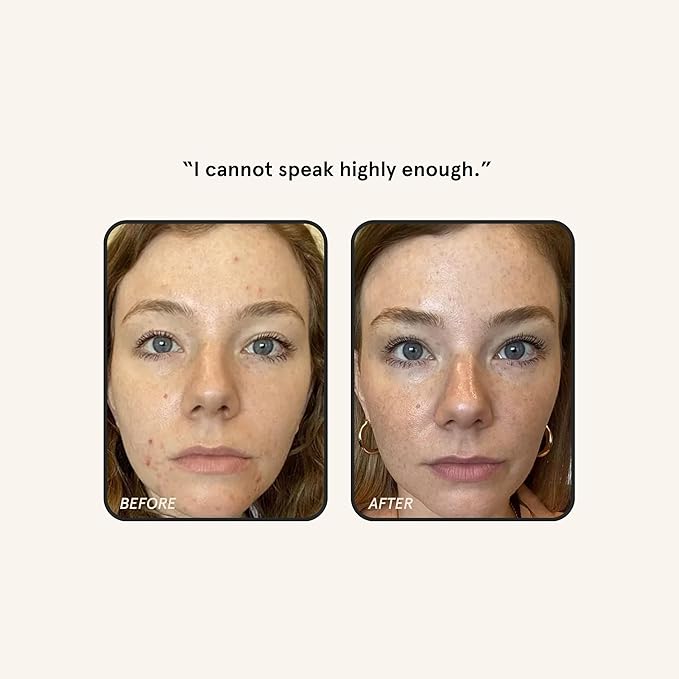 Barefaced Retinal Skin Therapy 30ml - Retinaldehyde & Bakuchiol Serum for Firming, Reducing Fine Lines & Wrinkles, Improving Skin Tone & Texture w/ Shea Butter, Jojoba Oil & Argan Oil-GlimoraGlow