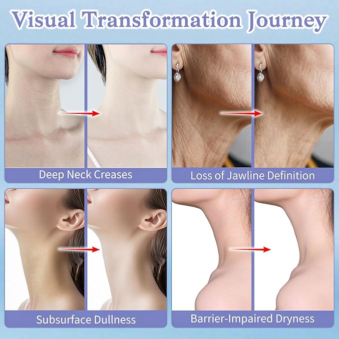 Neck Creams for Tightening and Firming - Anti Wrinkle & Treatment with Retinol Peptides, Ceramide - Overnight Moisturizer for All Skin Types - Sensitive Safe-GlimoraGlow