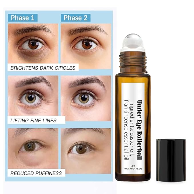 Time Eraser Rollerball Castor Oil and Frankincense, Time Eraser Rollerball, Castor Oil and Frankincense Eye Roller for Reducing Dark Circles and Bags Under Eyes-GlimoraGlow