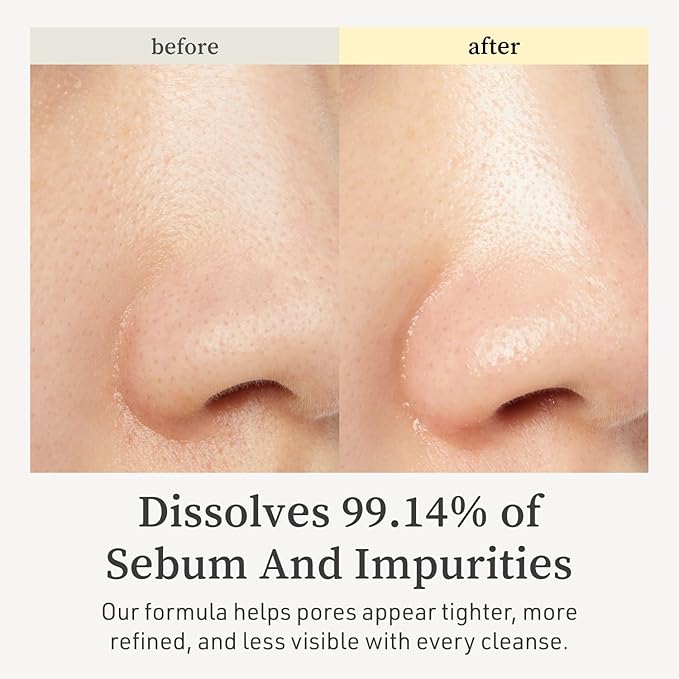 NOONI Facial Cleanser - Snow Aqua 0 LHA Toning Cleansing Oil | Makeup Blackhead Remover, Pore Control, Glass Skin, Help Control Sebum, Revitalizing, Moisturizing, Korean Skin Care, 6.76 Fl Oz (200 ml)-GlimoraGlow