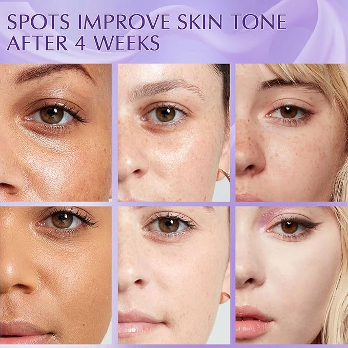 Dark Spot Remover for Face Cream, Dark Spot Corrector, Rapid Tone Repair Retinol Serum for Sun Spots, Age Spots, Skin Brown, Melasma Skin Care with Upgraded Formula Vitamin C for Women 1.7 Fl OZ-GlimoraGlow