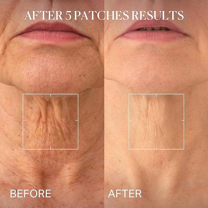 depology Tightening and Lifting Neck Wrinkle Patches with Cream, PDRN Deep Collagen Neck Mask, Firming Patch with PDRN、Collagen and Niacinamide Cream-GlimoraGlow