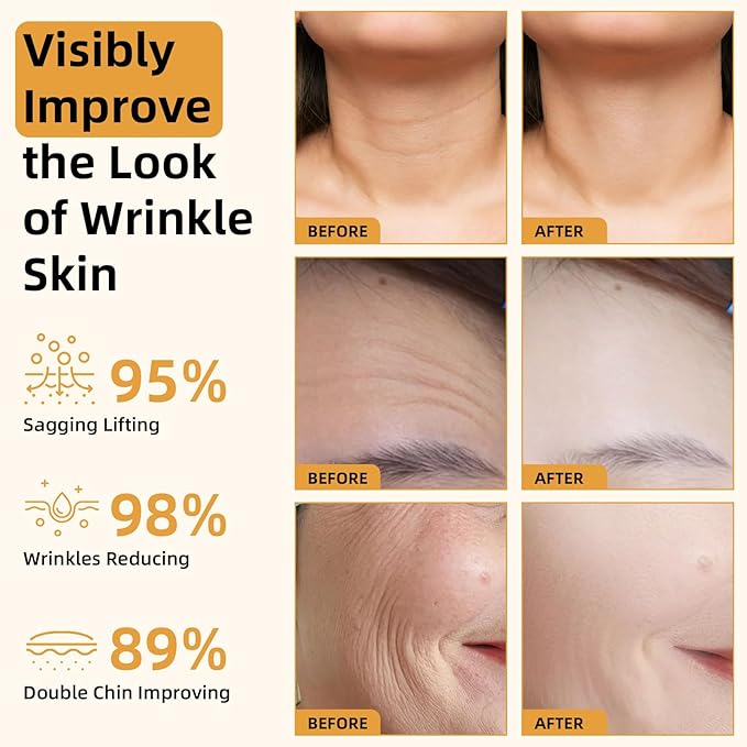 Bee Venom Firming Serum Stick, 2PCS Anti-Aging Face Cream, Lifts and Tightens the Skin, Hydrating, Lifting & Restoring Skin Elasticity, Bee Venom Body Tightening Cream for Women & Men-GlimoraGlow