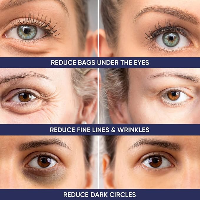 Instant Ageless Eye Cream – Anti Wrinkle Cream, Removes Under Eye Puffiness, Bags, Expression Lines, & Dark Circles. Powerfully Tighen & Lifts Sagging Skin. Disappears Before Your Eyes In Minutes.-GlimoraGlow