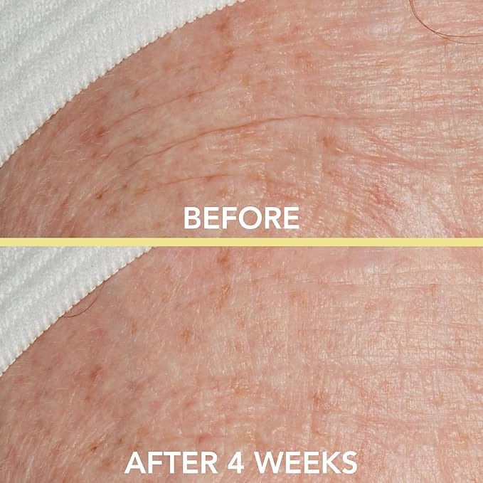 Lancer Skincare Triple Peptide Drops with Vitamin E, Daily Anti-Aging Face Serum with Hydrating Hyaluronic Acid, 1 Fluid Ounce-GlimoraGlow