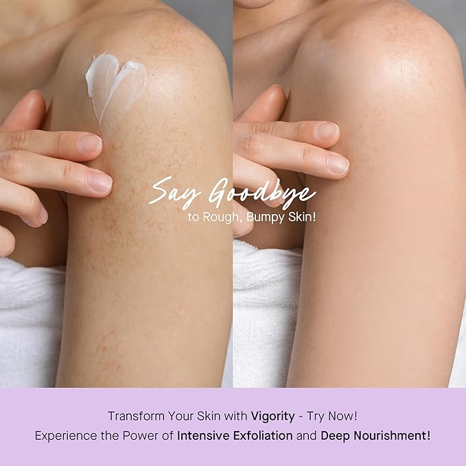 Vigority Keratosis Pilaris Treatment Cream with Lactic Acid – KP Body Bump Exfoliating Moisturizer for Rough, Bumpy, Dry & Flakey Skin, Strawberry Legs – 5.1 Oz-GlimoraGlow