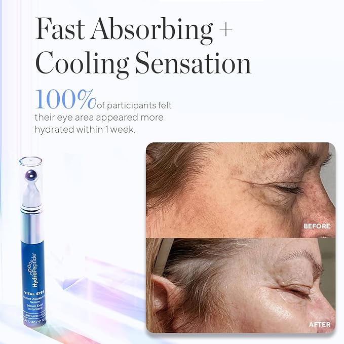 HydroPeptide Vital Eyes, Instant Awakening Serum, Cooling Rollerball, Hydrate and Brighten, 0.3 Ounce-GlimoraGlow